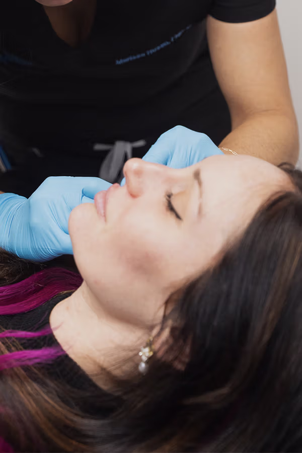 CAMI provider performing treatment at the corners of the mouth for downturned smile correction