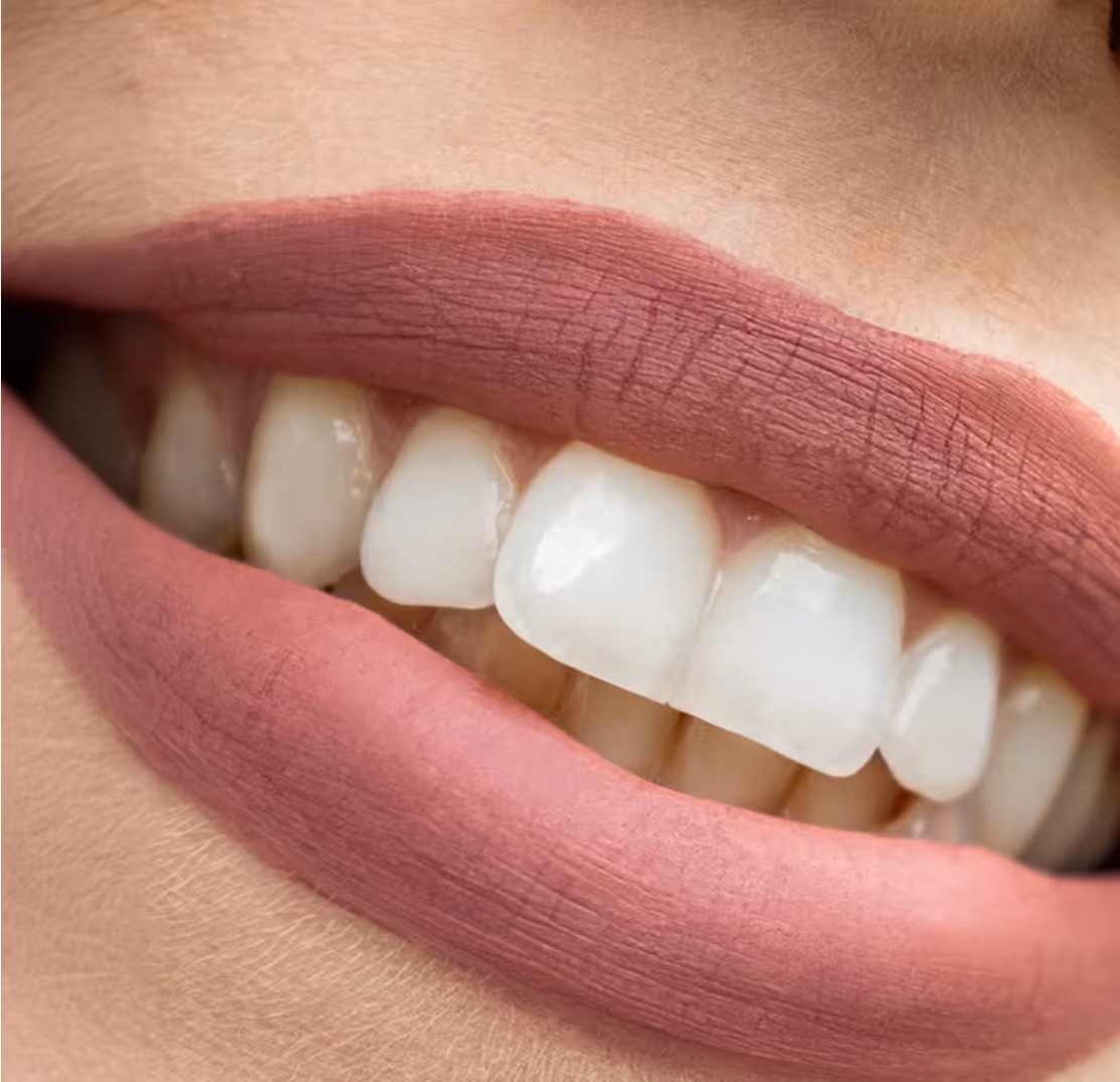 Sourire - LovelySmile