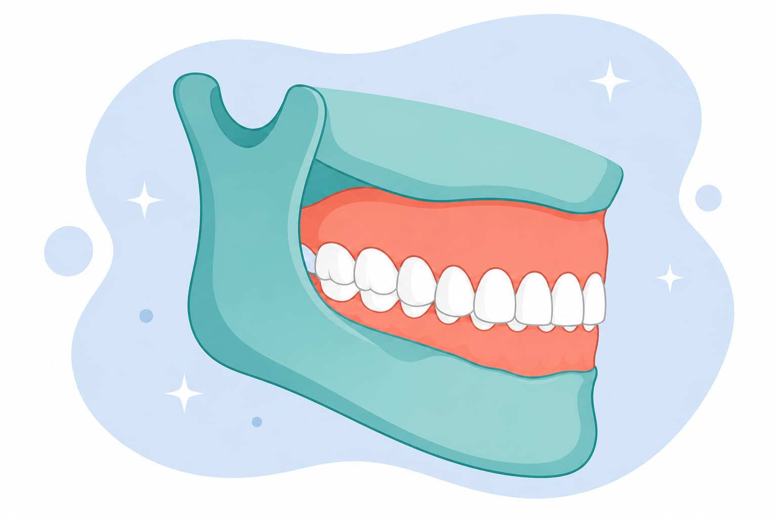 Side illustration of upper front teeth overlapping the lower front teeth too far, showing a deep bite