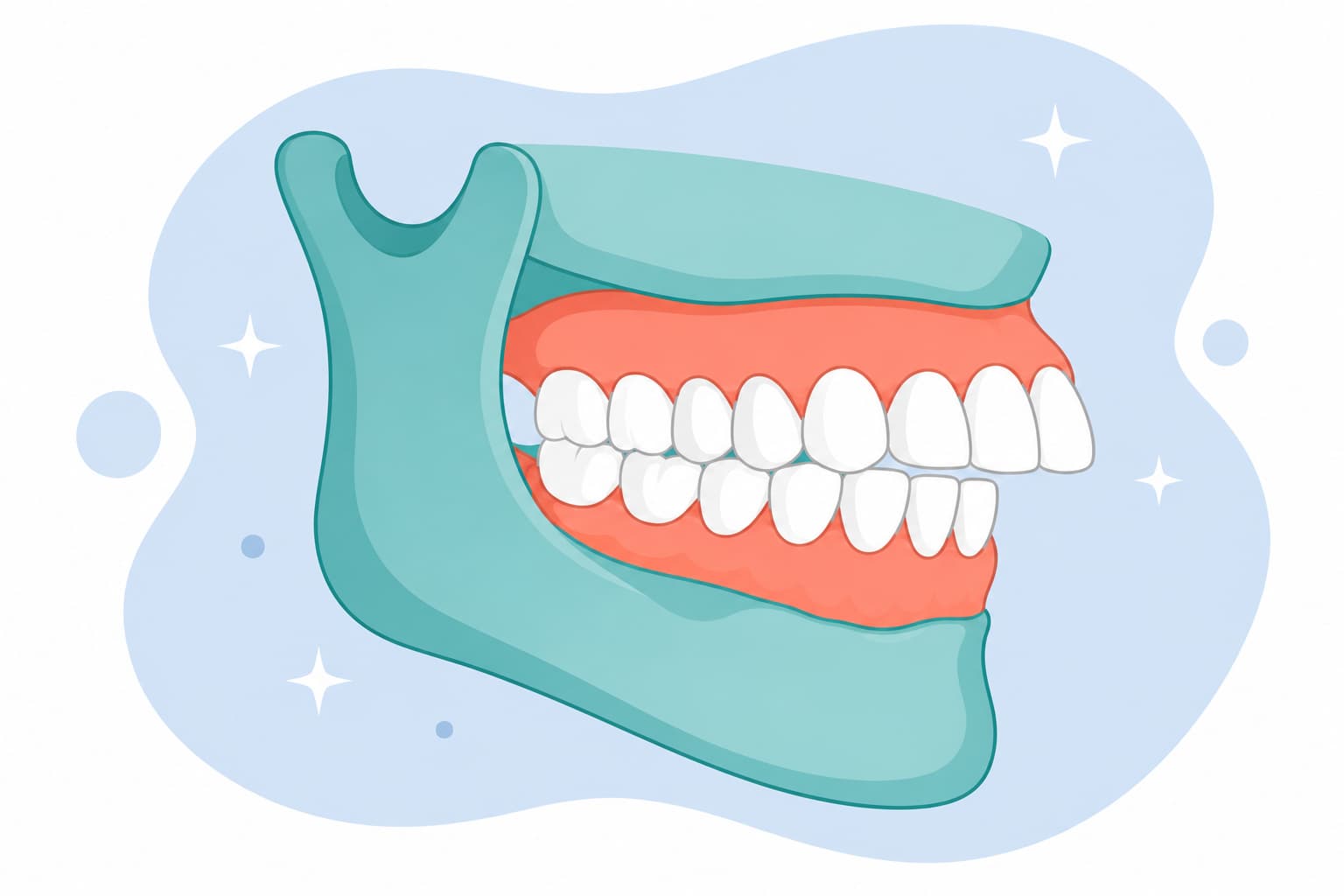 Side illustration of upper front teeth protruding horizontally over the lower teeth, showing an overjet