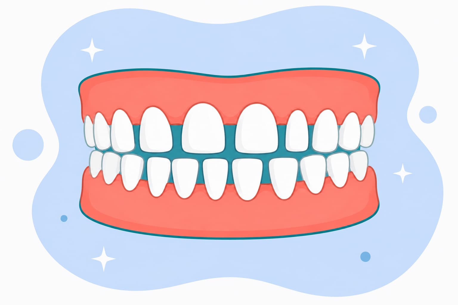 Illustration of front teeth with visible gaps and spacing between them