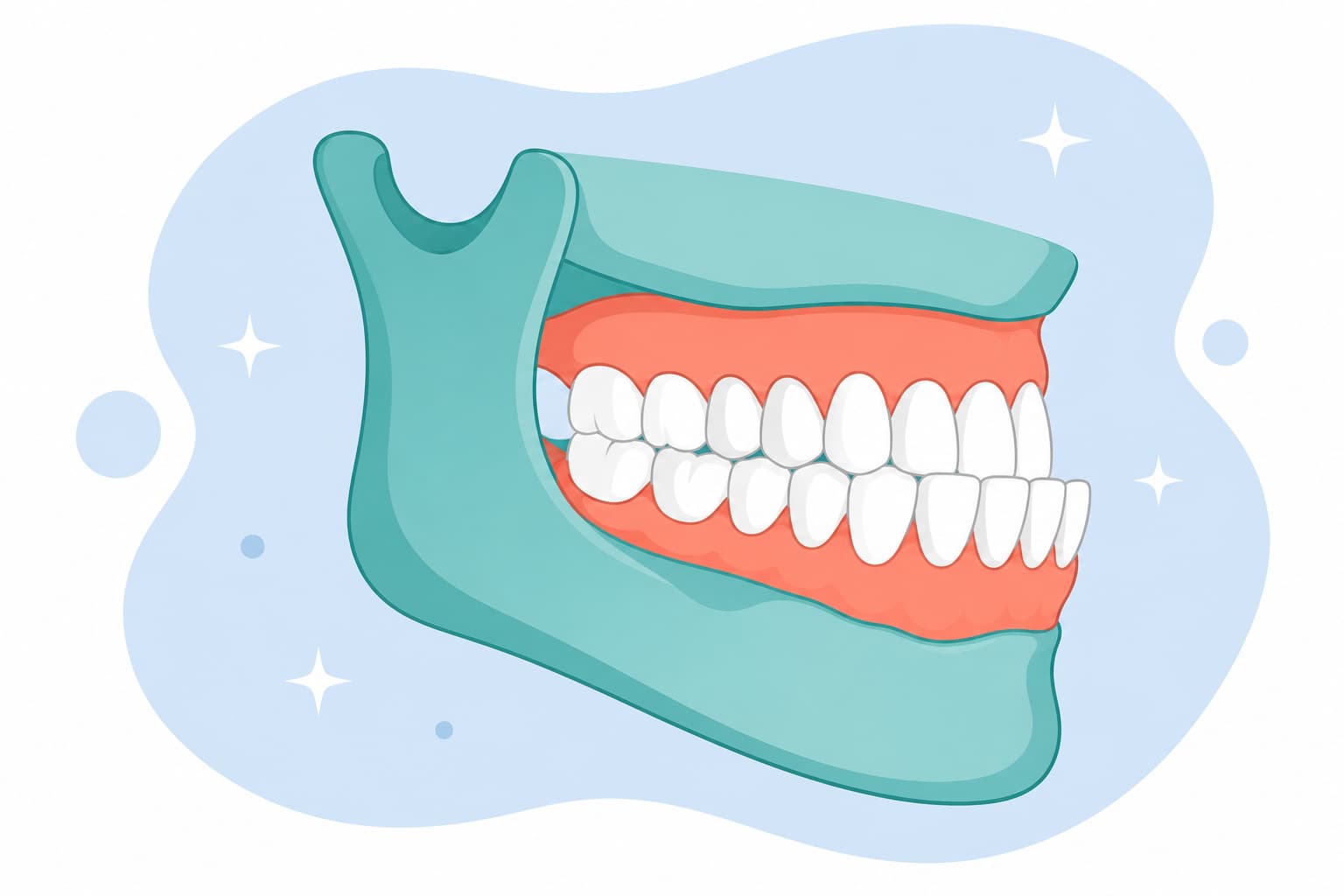 Side illustration of lower front teeth sitting ahead of the upper front teeth, showing an underbite