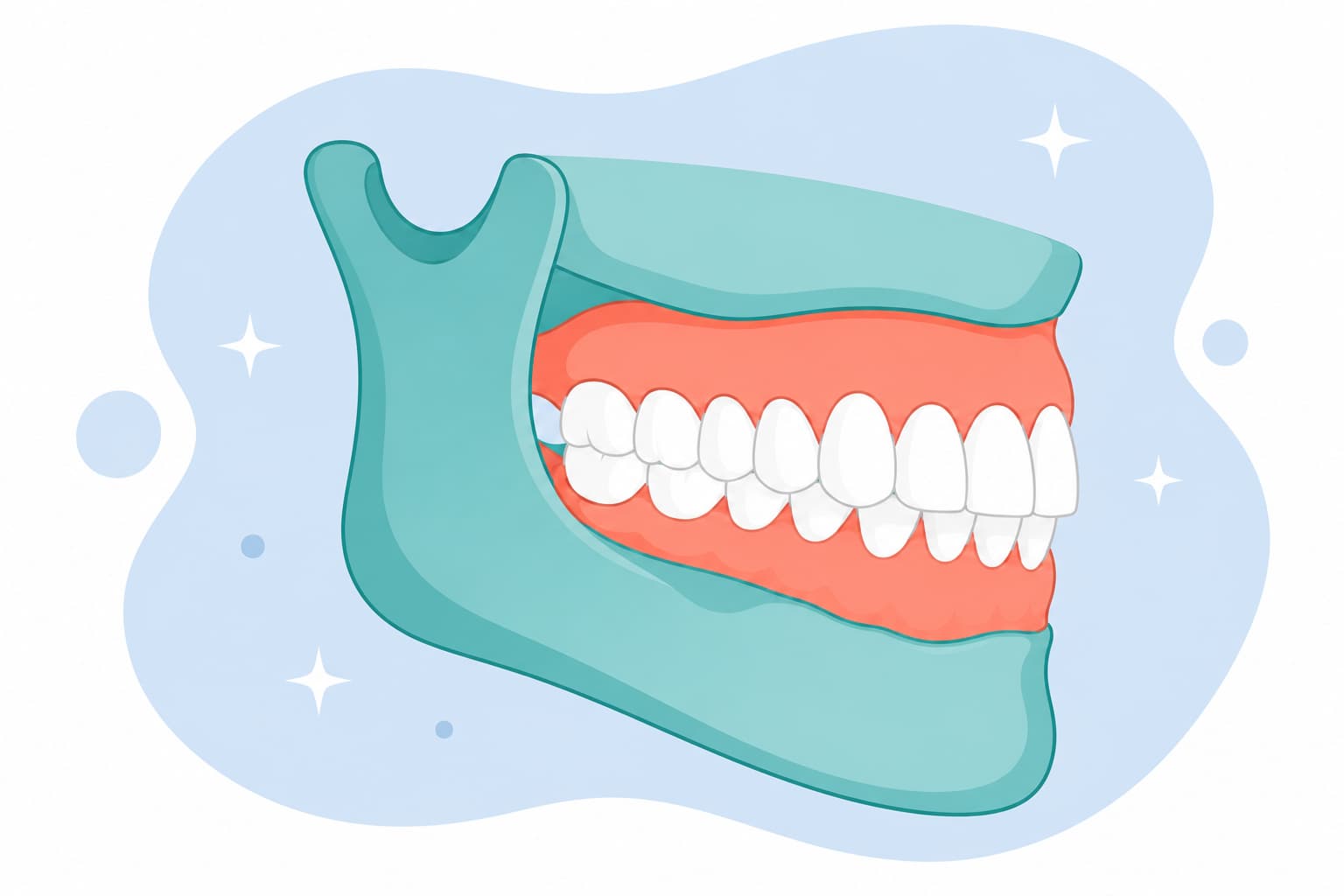 Side illustration of upper front teeth overlapping the lower teeth, showing an overbite