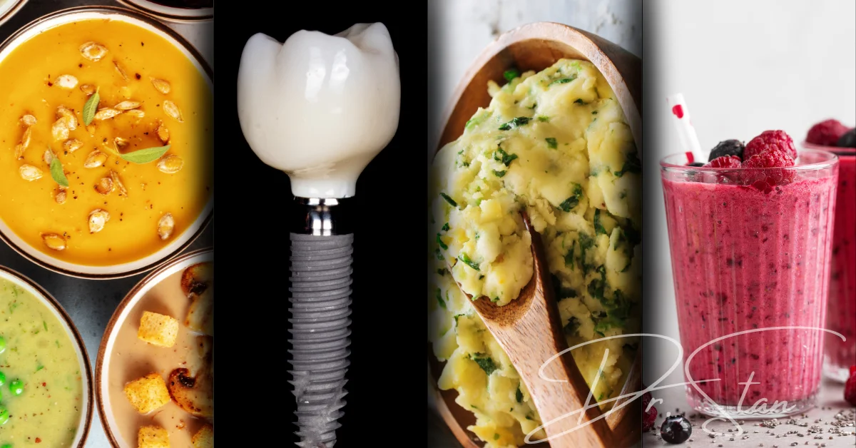 Alimentația după implant dentar - ce alimente poți mânca în perioada de vindecare postoperatorie