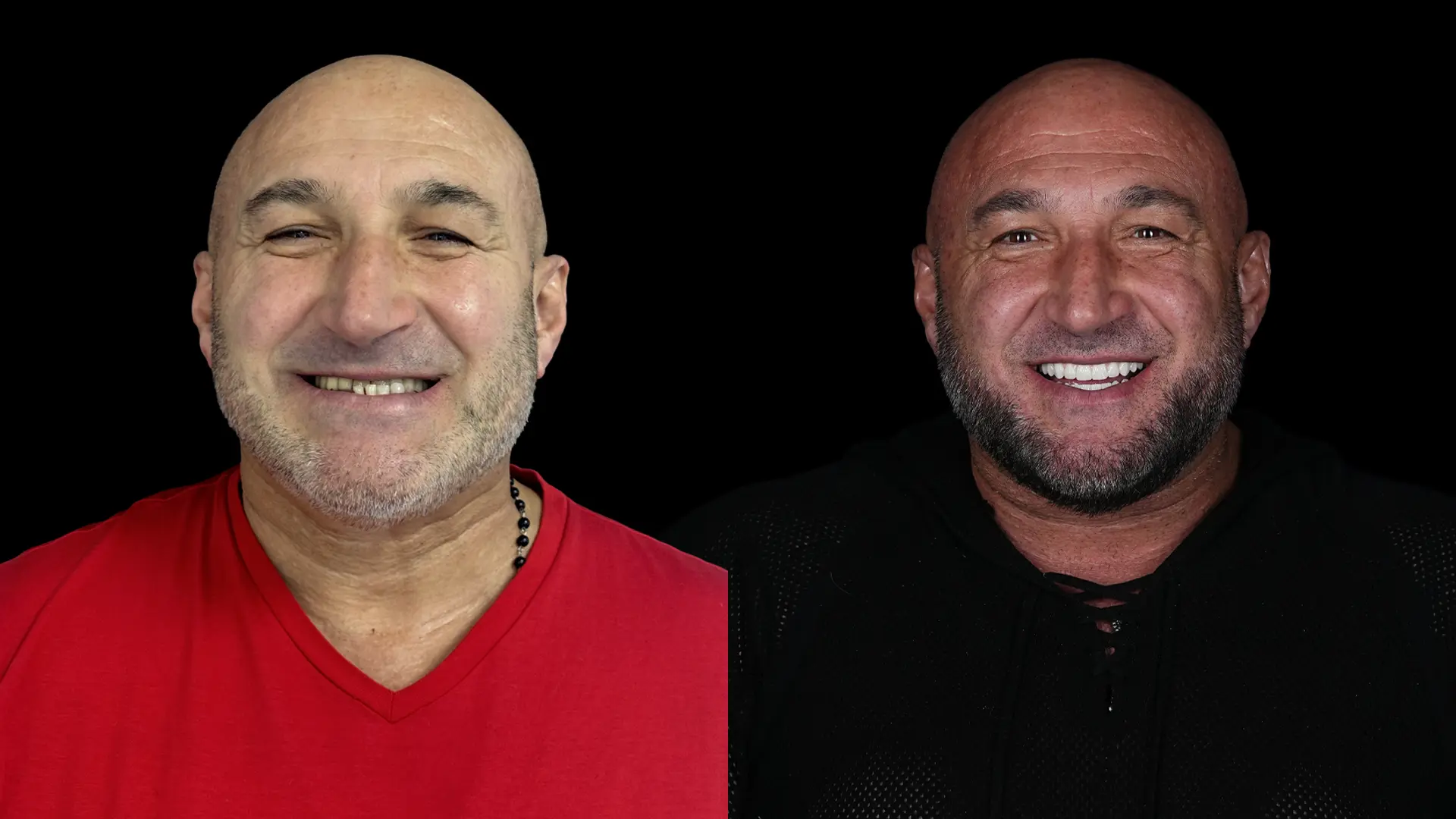 Recuperarea după implant dentar - indicații postoperatorii pentru o vindecare optimă