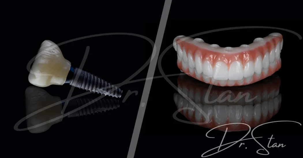 Implant dentar NEODENT by Straumann - tratamente disponibile și prețul implantului