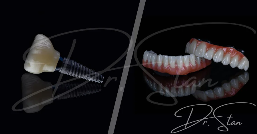 Implant dentar Straumann - tipuri, avantaje și prețul implanturilor premium elvețiene