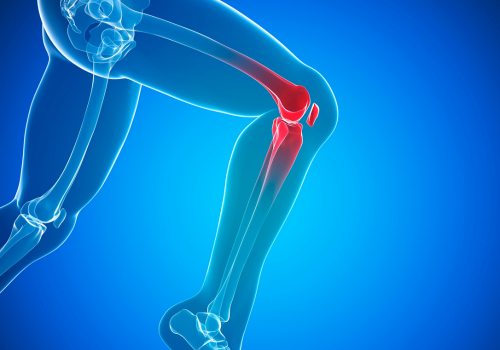 CBD for Knee Pain: Relief, Dosage & Usage Tips 