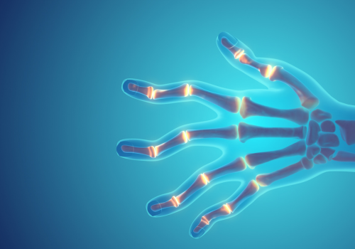 Can CBD & THC Oil Relieve Arthritis Pain? Benefits, Risks & How to Use It