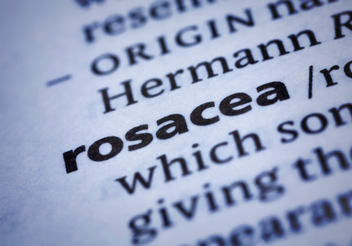 CBD for Rosacea: Benefits, Treatment, and Uses for Skin Relief