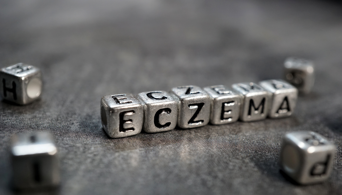 Cannabis for Eczema: Can It Help?