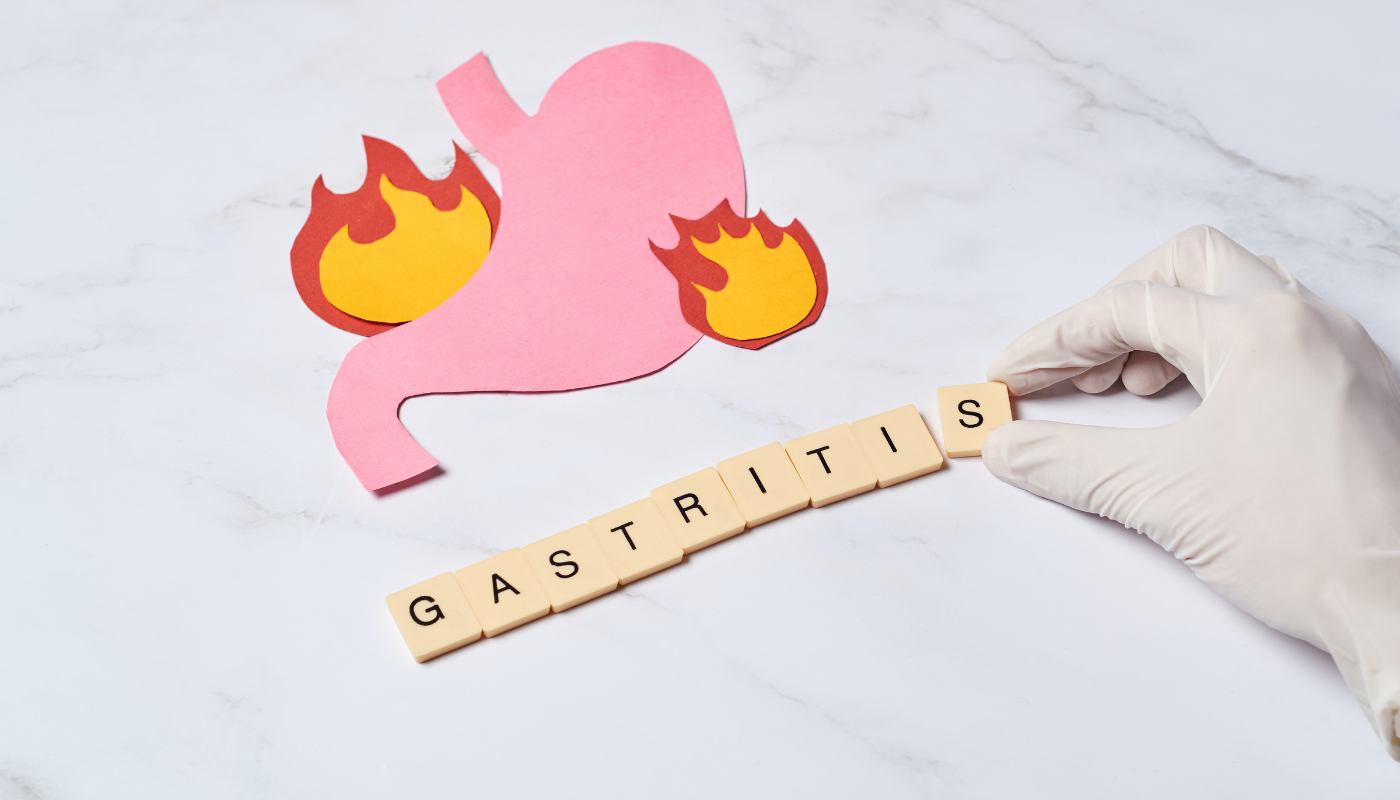 Medical Cannabis for Gastritis: Can It Help Ease Inflammation and Pain?