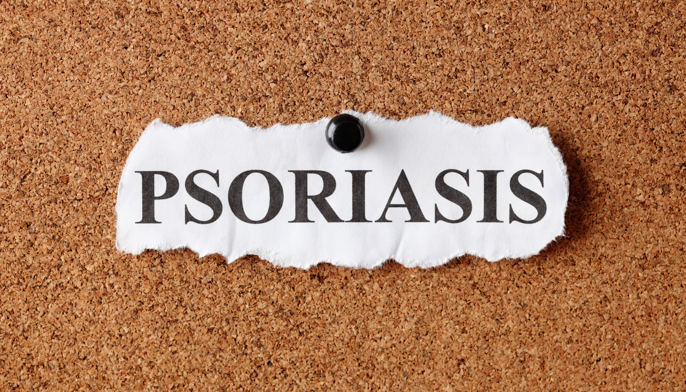 Cannabis and Psoriasis: Can It Help?