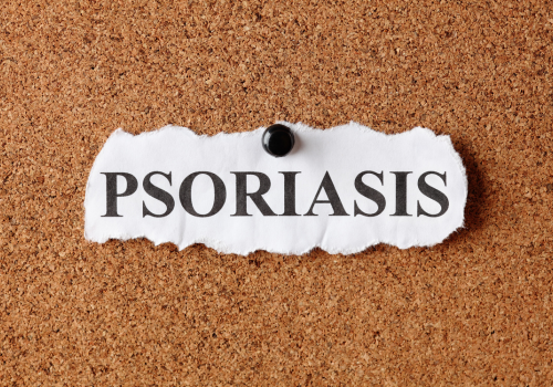 Cannabis and Psoriasis: Can It Help?