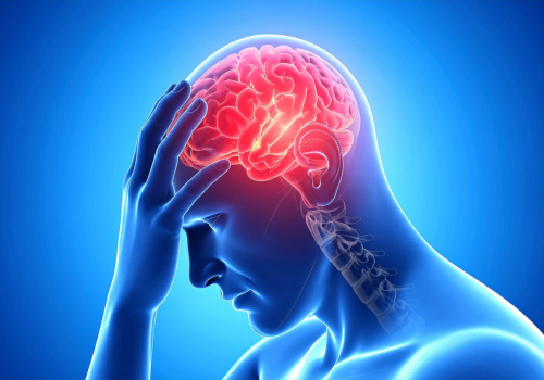 Medical Cannabis for Cluster Headaches: Symptom Relief & Access in the UK