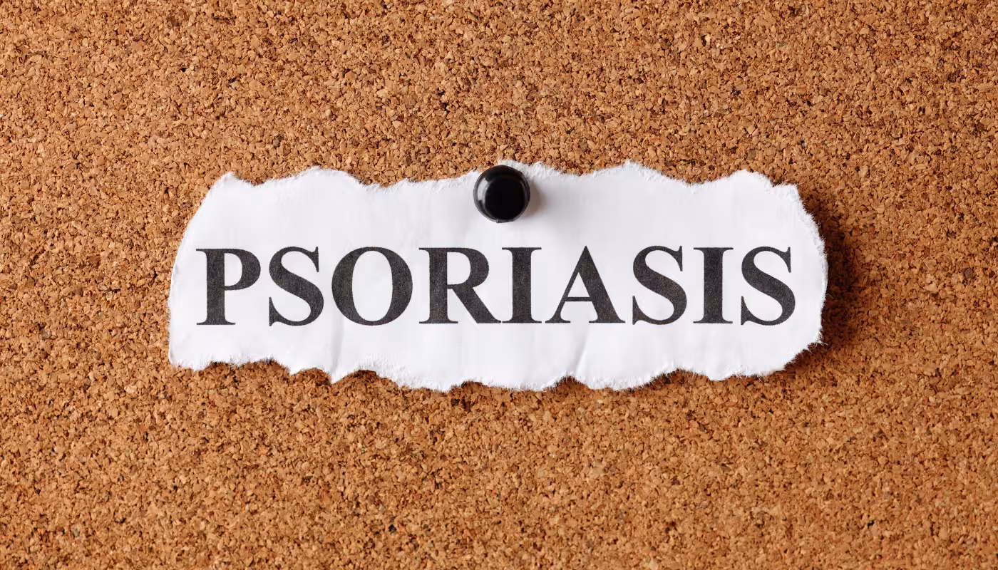 Cannabis and Psoriasis: Can It Help?