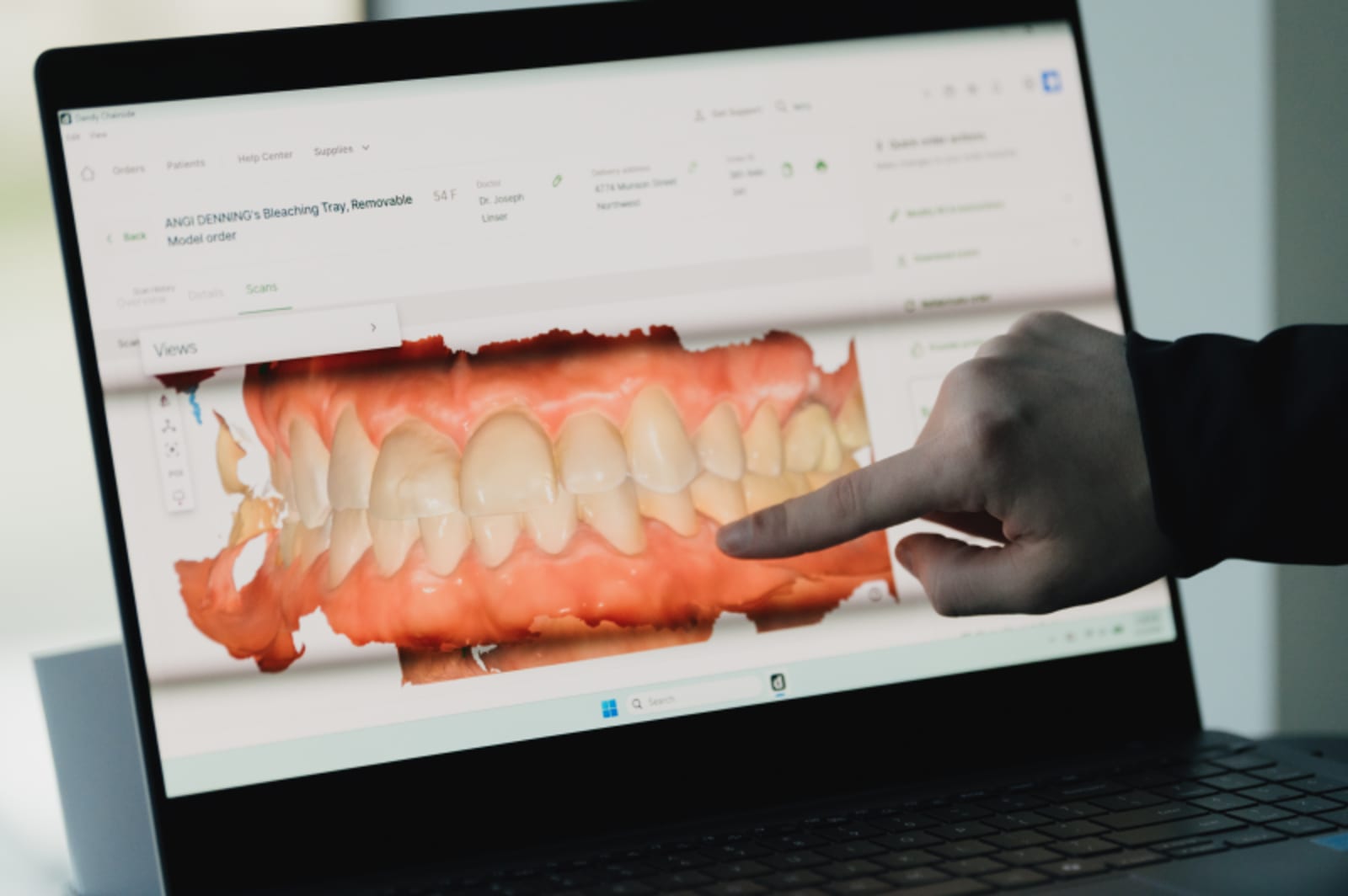 Dentist pointing to digital dental implant scan on computer screen