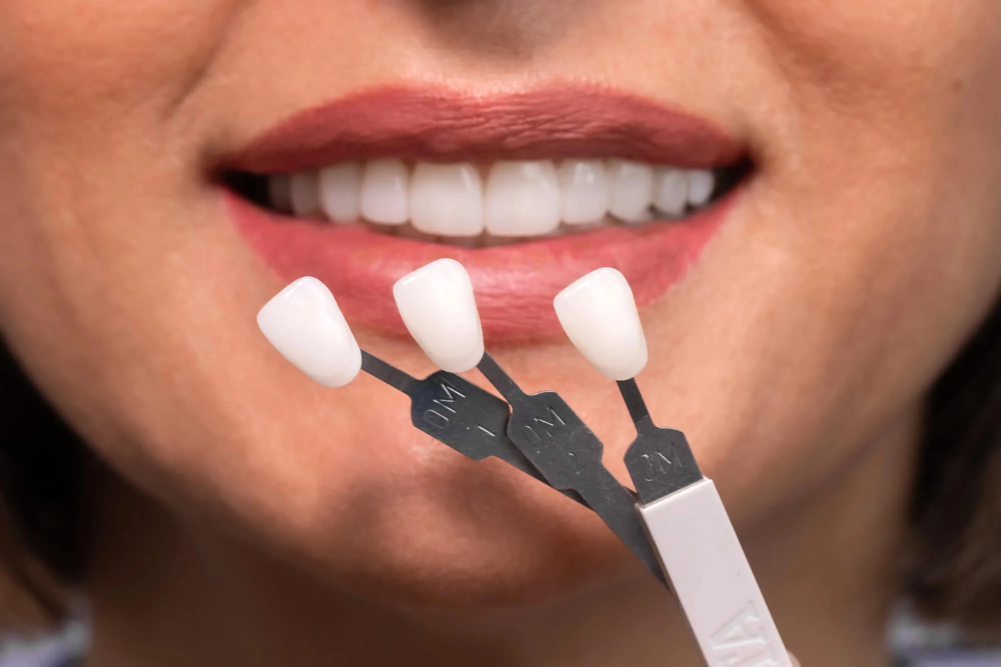 Woman smiling with dental veneers shade guide held near her teeth for color matching.