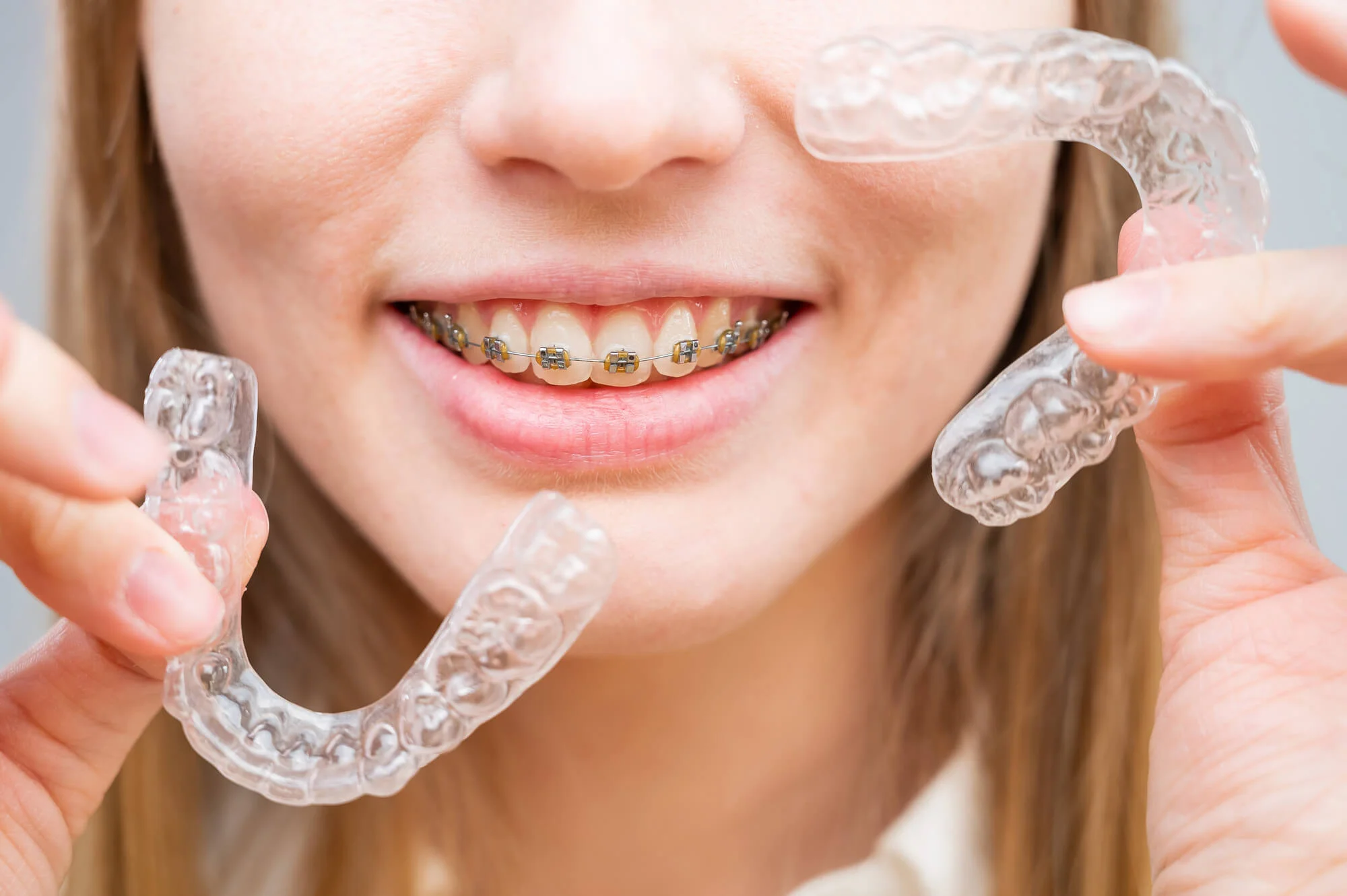 Smiling person with metal braces holding two clear Invisalign aligners.