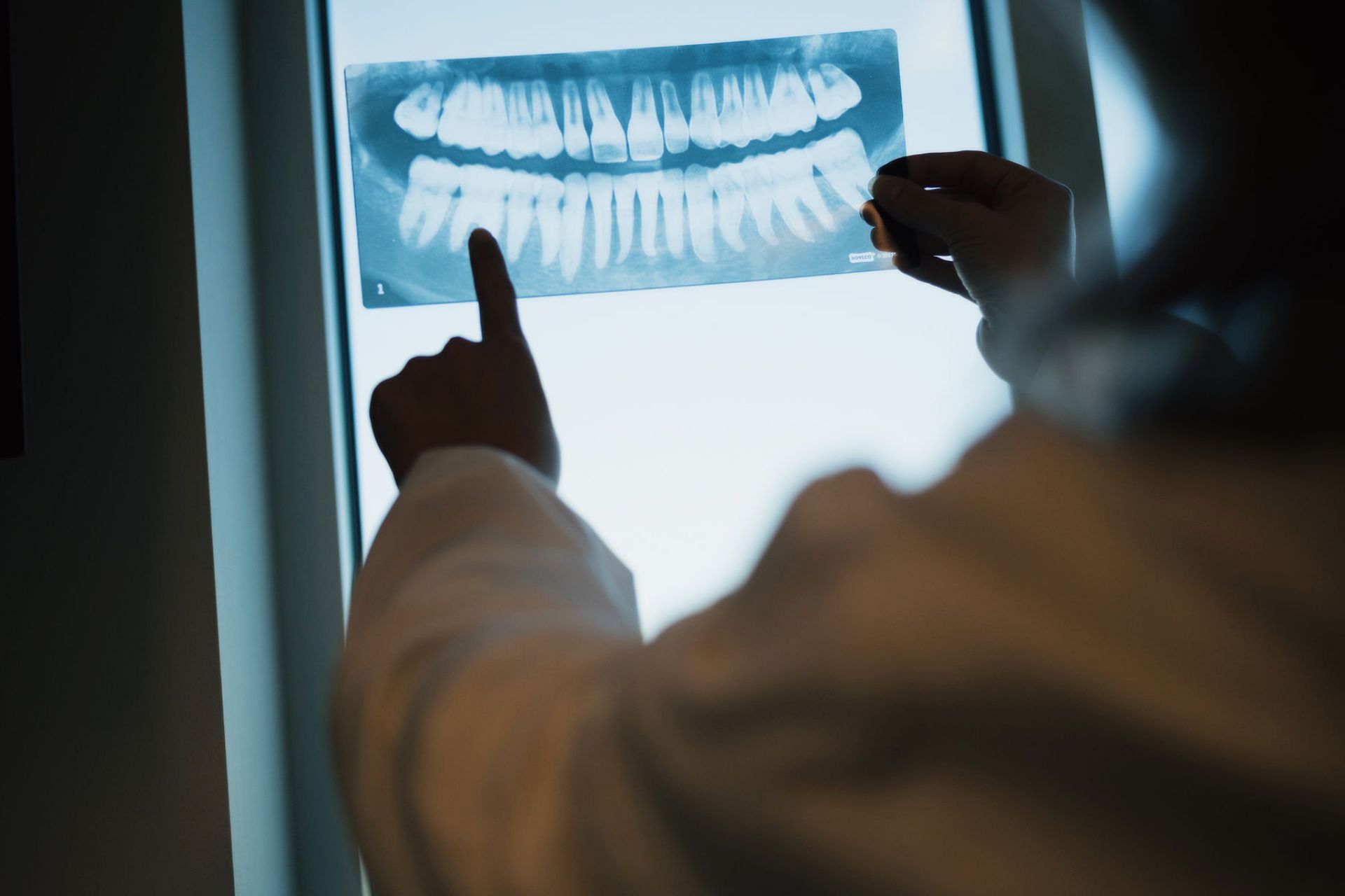Person in white coat pointing at a dental X-ray showing upper and lower teeth.
