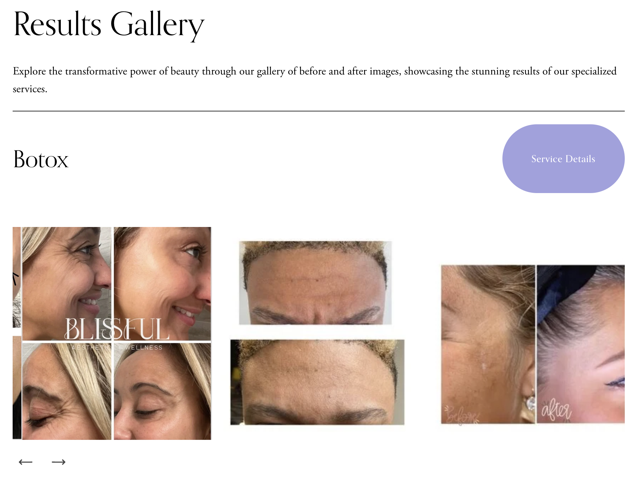 Blissful Aesthetics results gallery with before-and-after imagery linking back to service pages