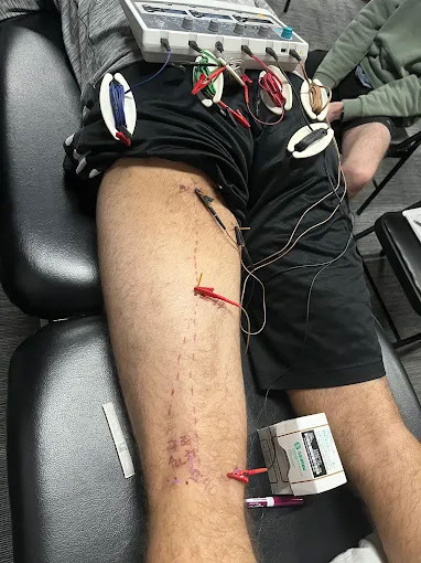 Performance Physical Therapy in Cumming, GA
