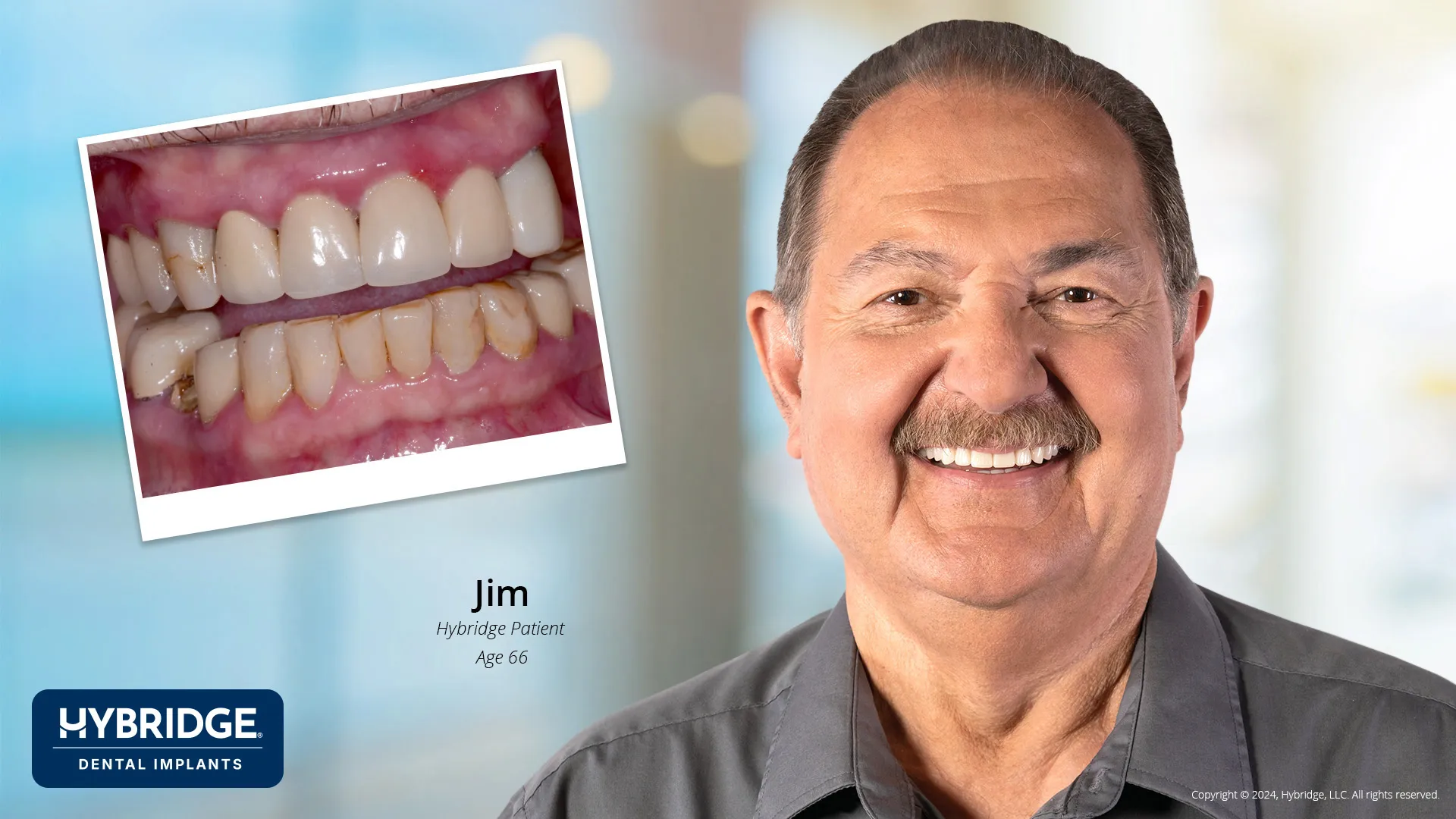 Jim Before & After