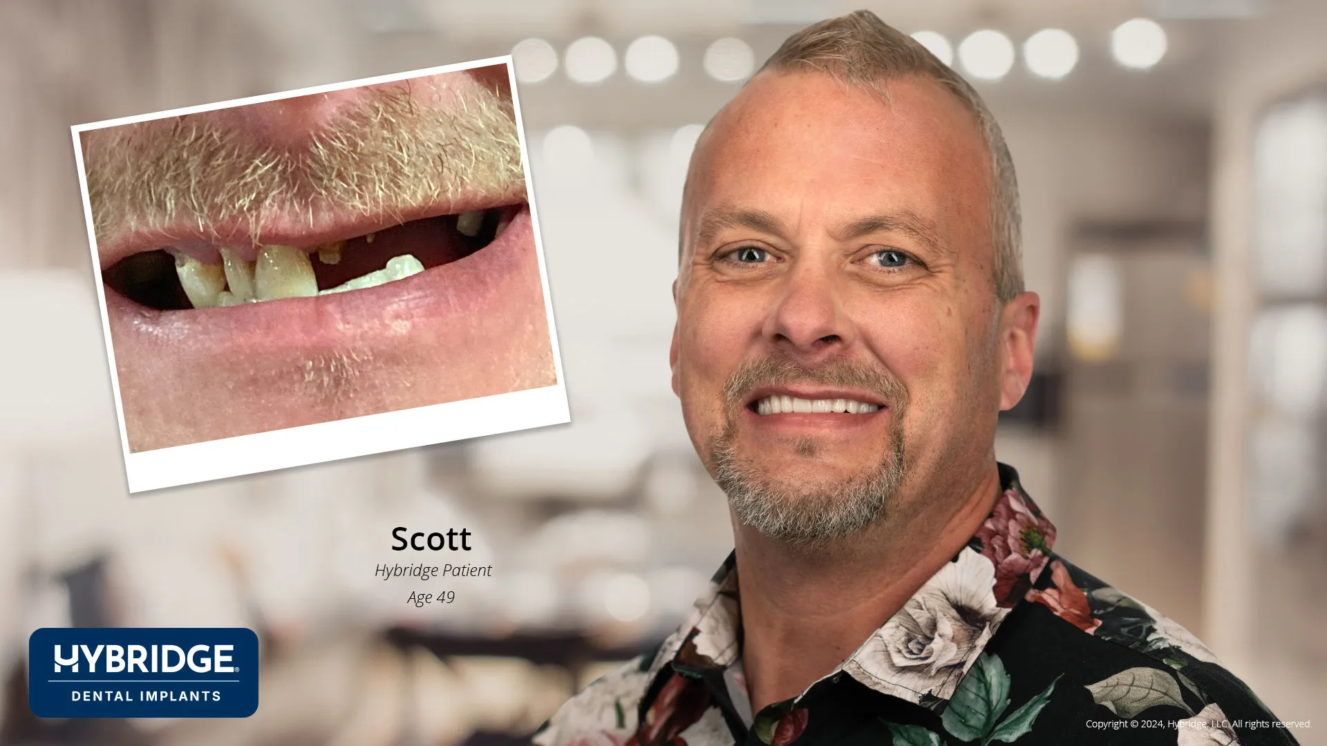 Scotty Before & After