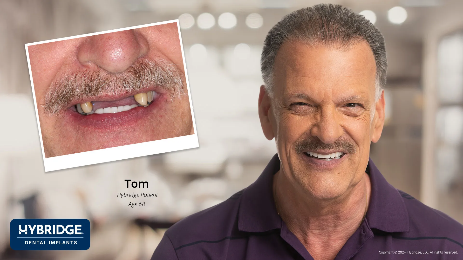 Tom Before & After