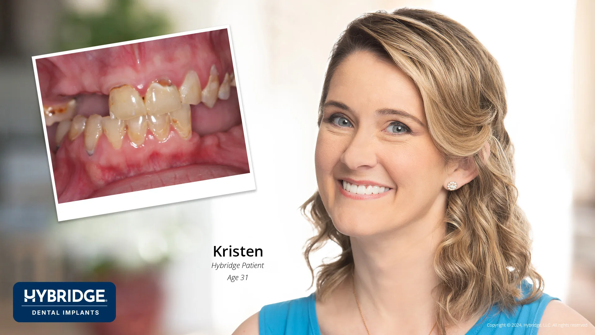 Kristen Before & After