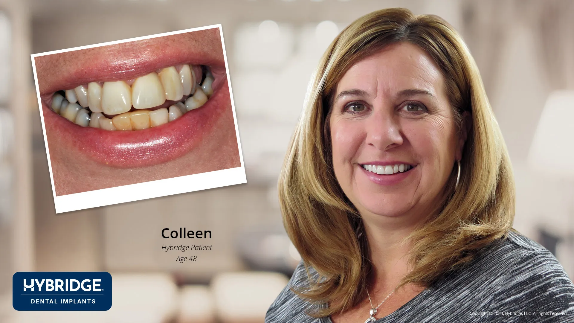 Colleen Before & After