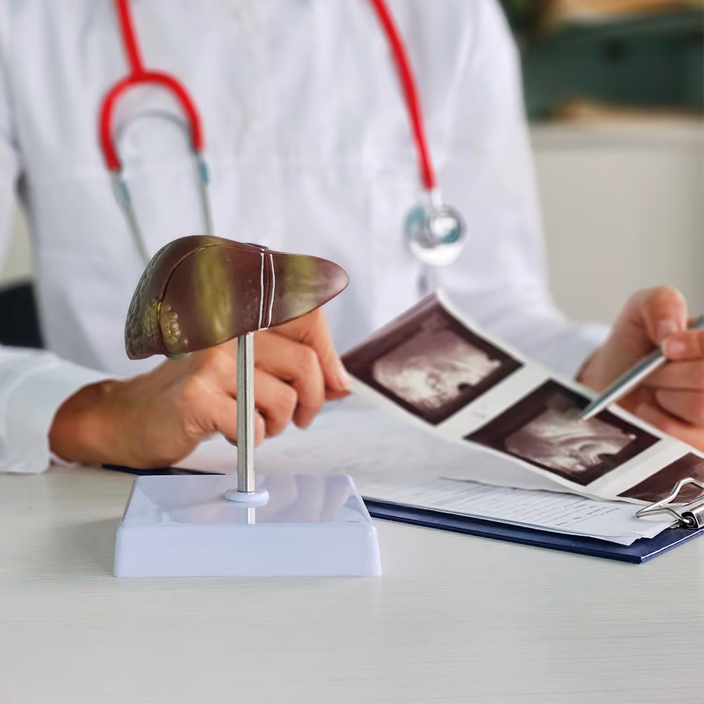 Doctor discussing liver fibrosis with a patient using liver ultrasound images and an anatomical liver model during a clinical consultation.