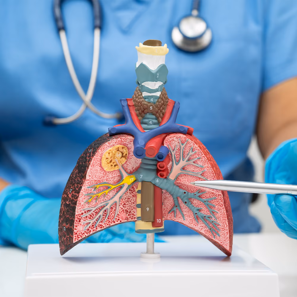 Healthcare professional using an anatomical model to explain fatty liver disease and its effects on the lungs and surrounding anatomy during a patient consultation.