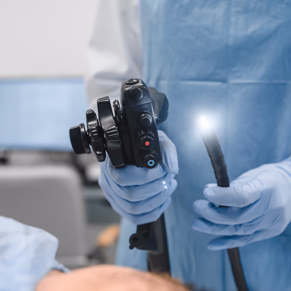 Healthcare professional holding a gastroscope before performing a gastroscopy procedure in a clinical setting.