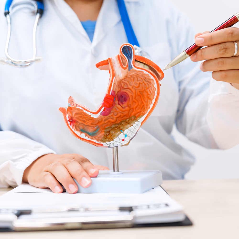 Doctor using a stomach model to explain digestive health and gastrointestinal conditions during a gastroenterology consultation.