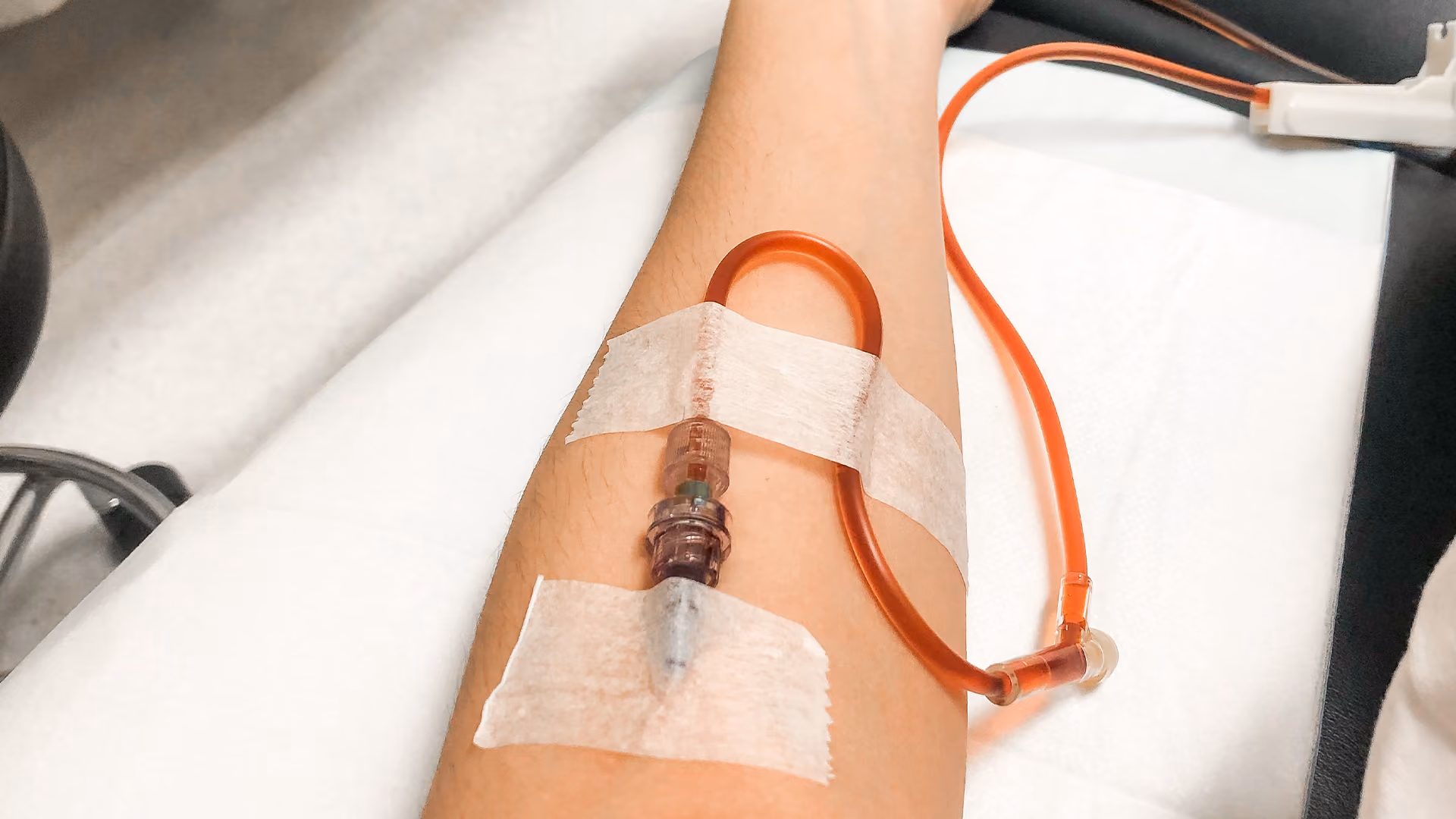 Close-up of an IV cannula delivering an iron infusion into a patient's arm, secured with medical tape during treatment.