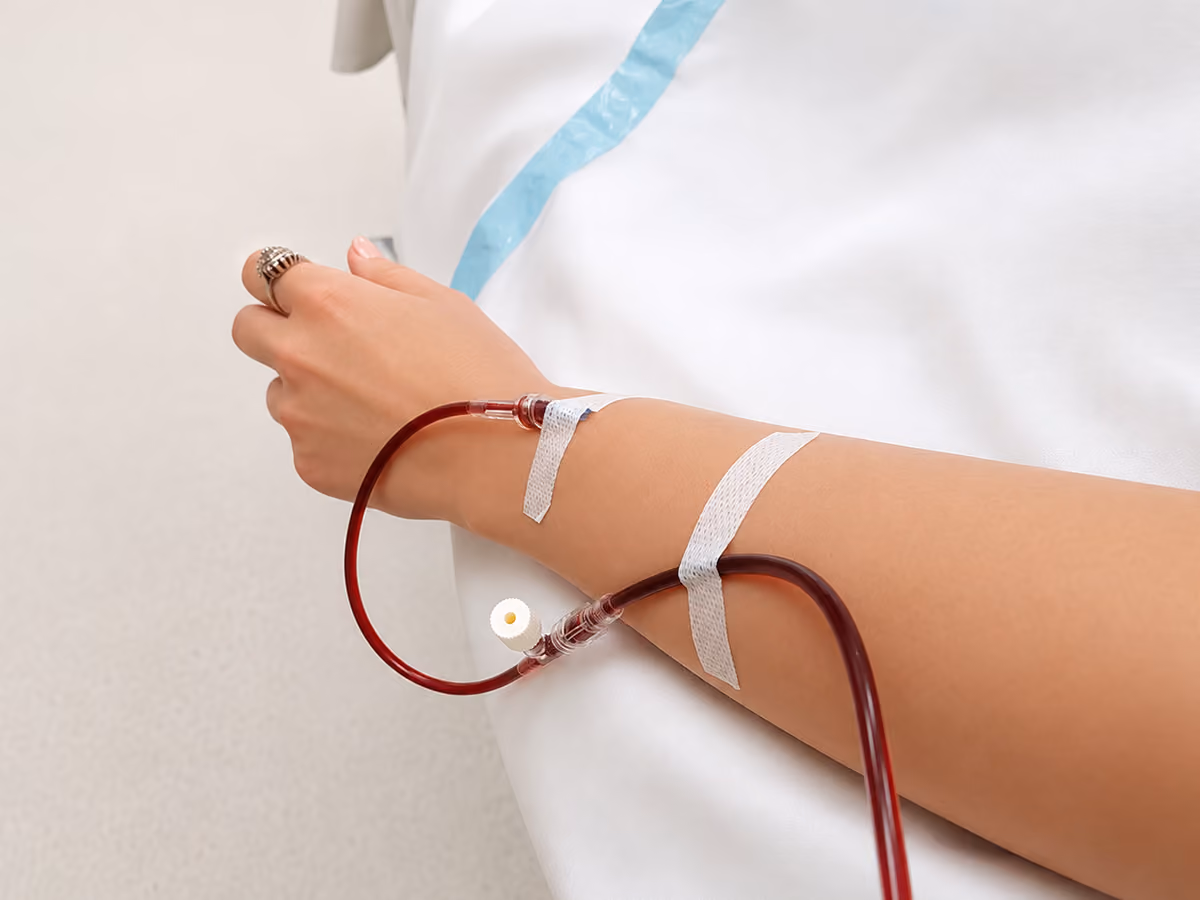 Close-up of an arm with an IV cannula secured in place during an iron infusion, with blood-filled tubing connected in a clean clinical setting.