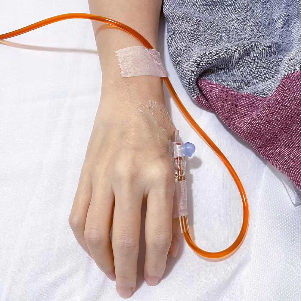 Close-up of a patient's hand with an intravenous cannula in place during an iron infusion treatment.