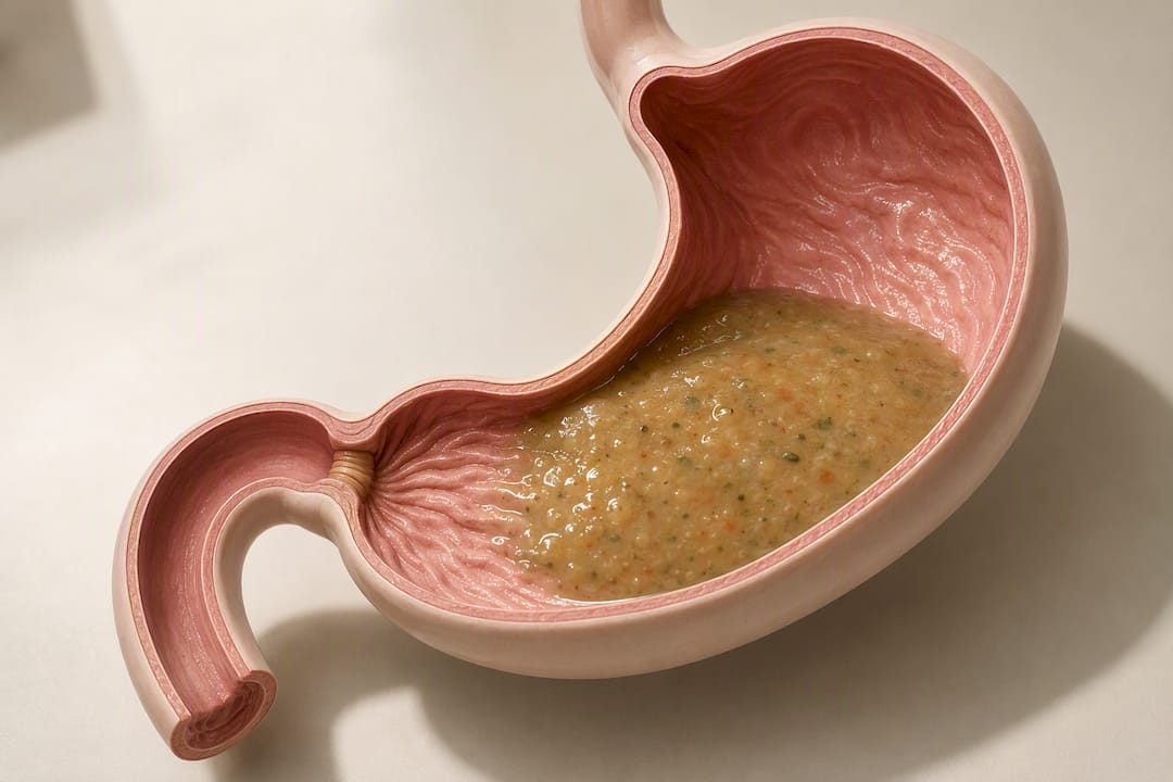 Illustration of three stomach motility changes