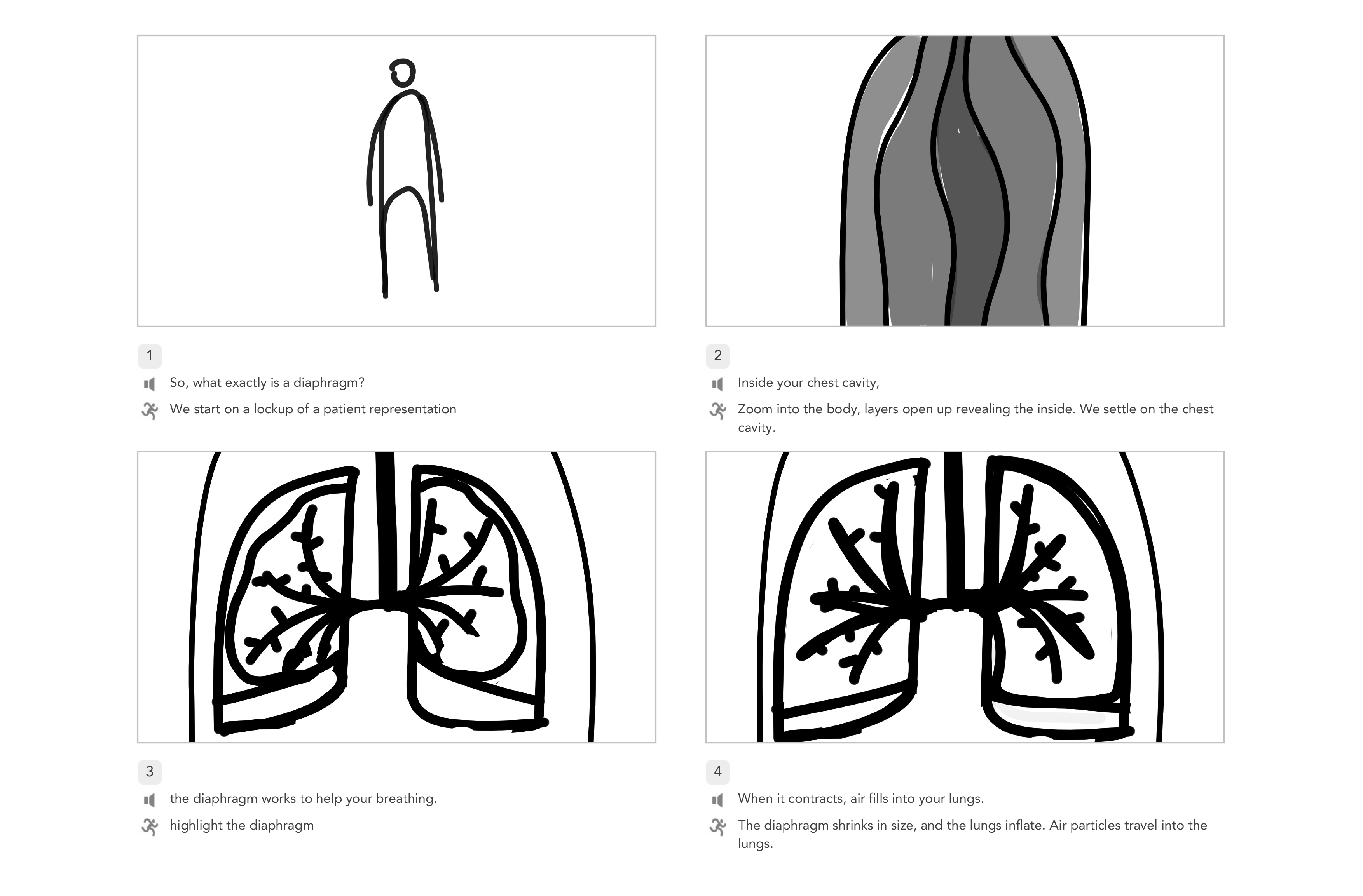 Surgery Explainers