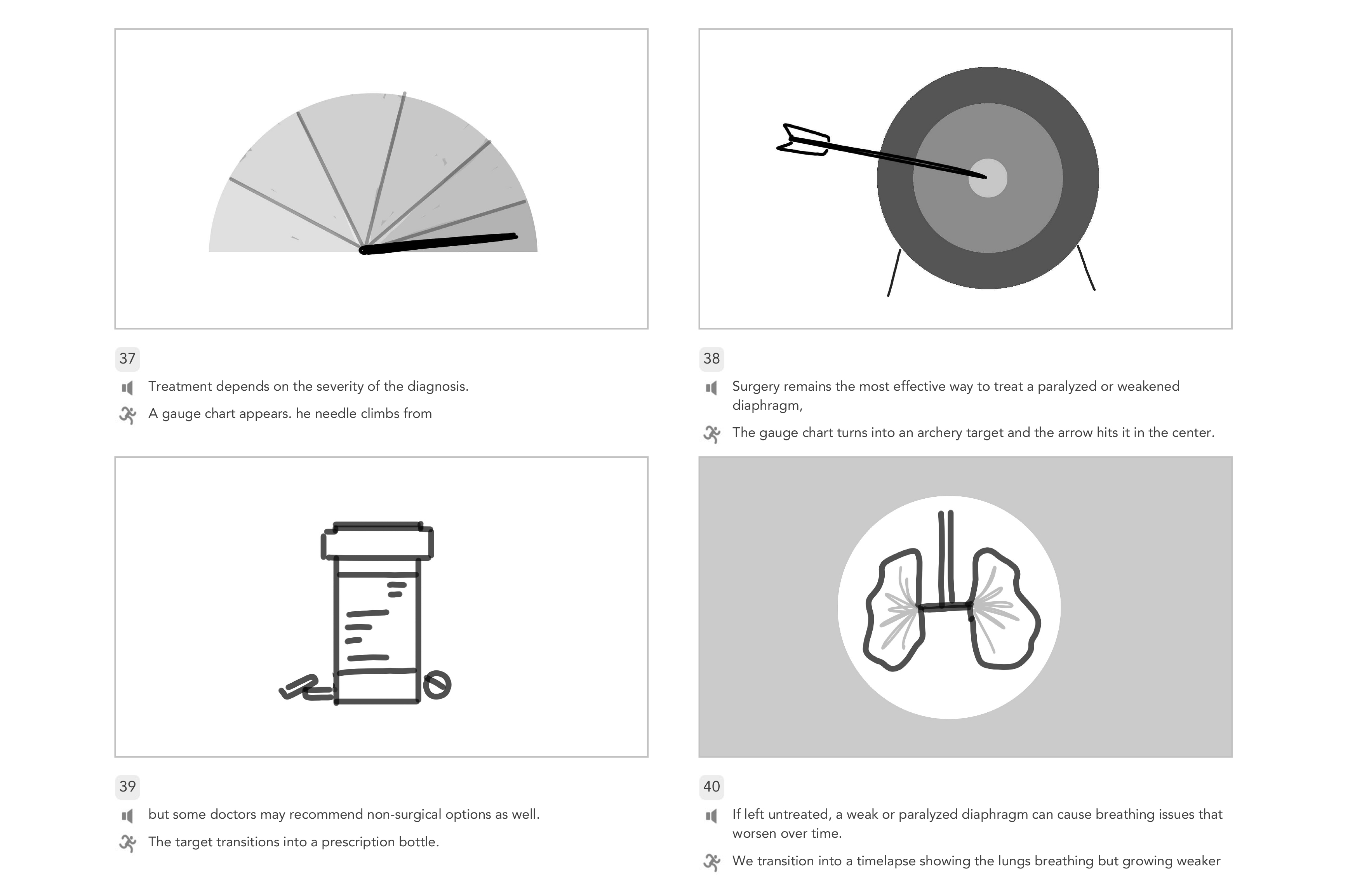 Surgery Explainers