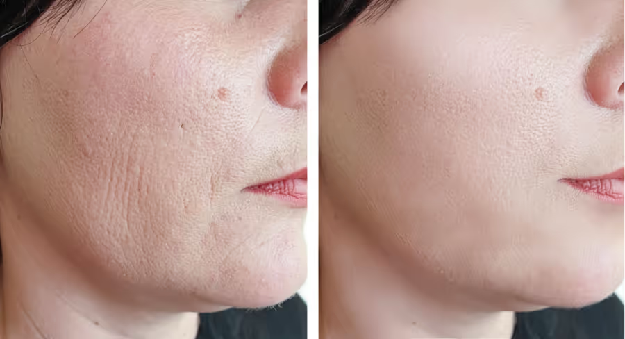 DoctorDerm Anti-Aging Care results