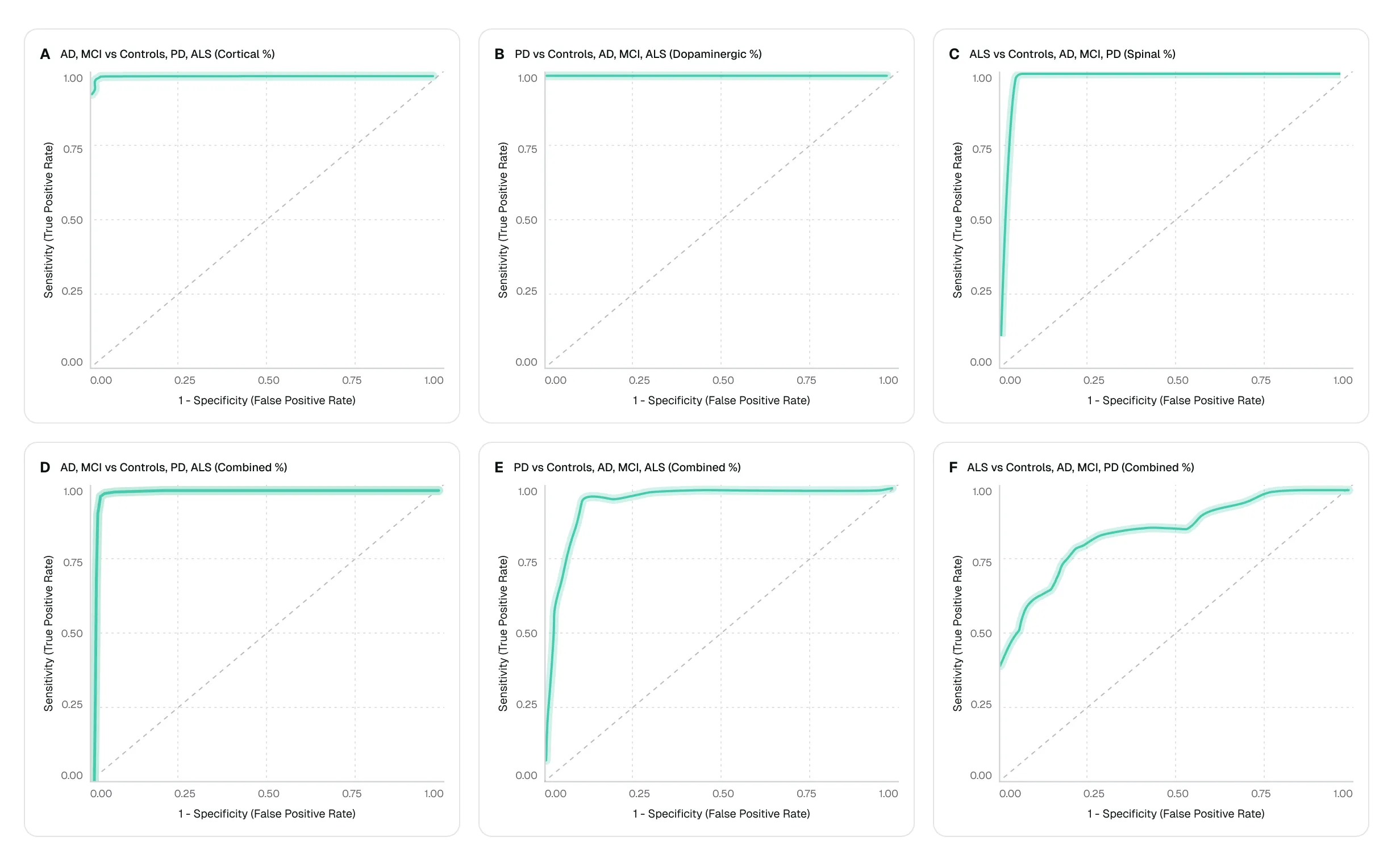 Six ROC curves comparing sensitivity and false positive rates for AD, MCI, PD, ALS across brain regions and combined data.