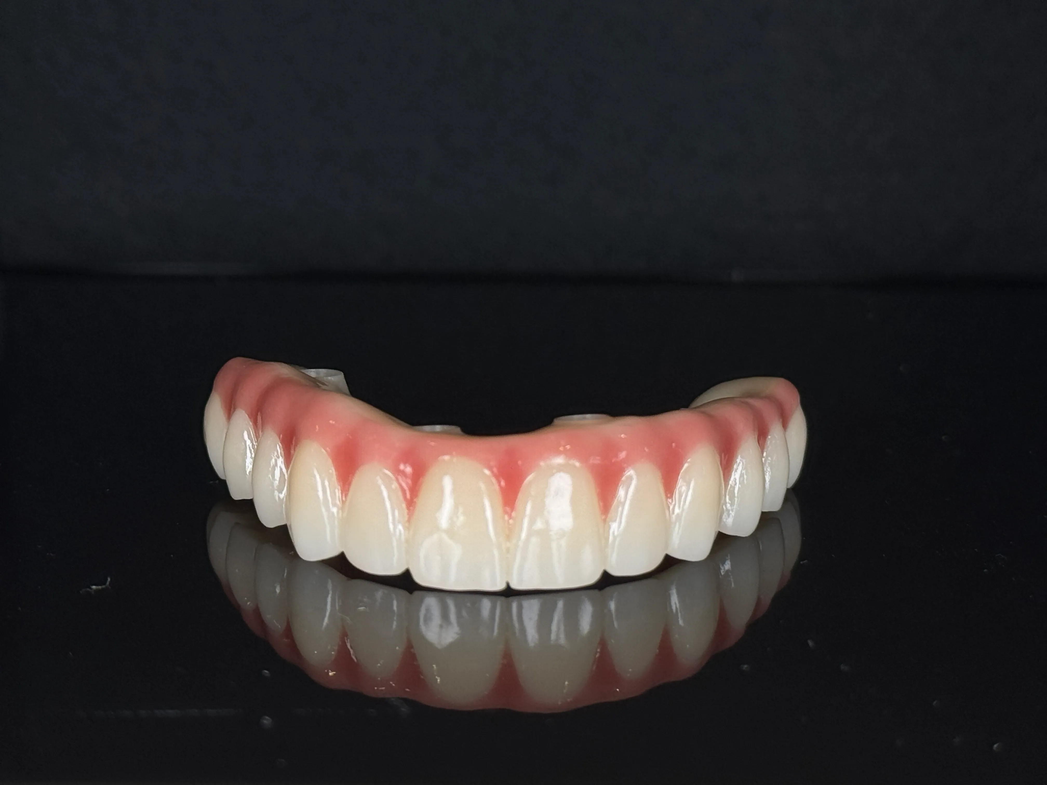 Full arch of dental implant crowns showing an All-on-X prosthetic at Livewell Dental
