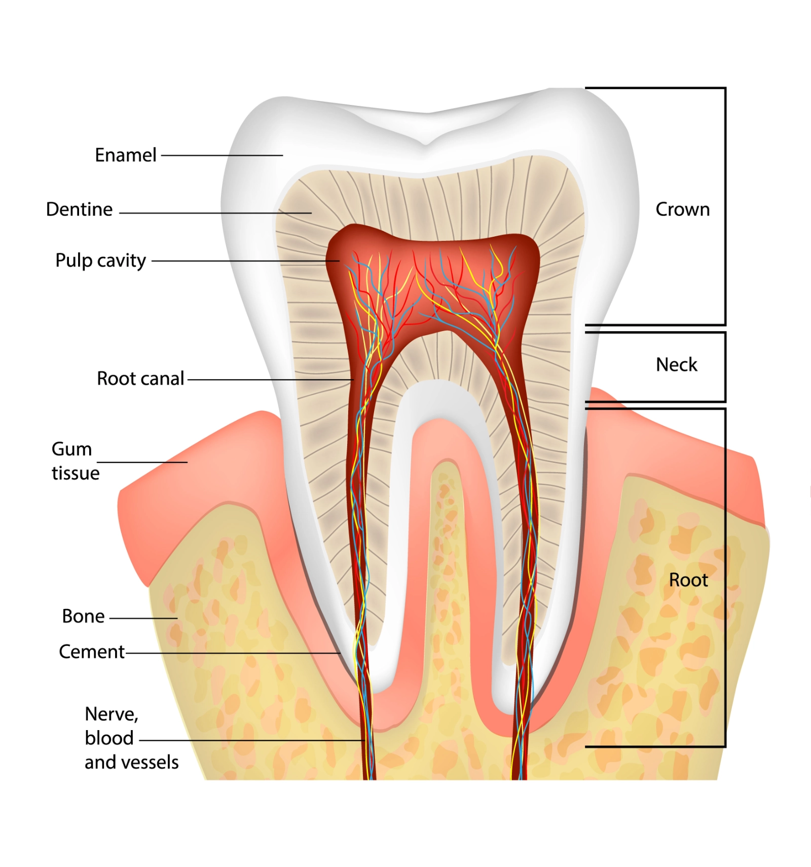 Cross-section diagram showing root canal treatment inside a tooth