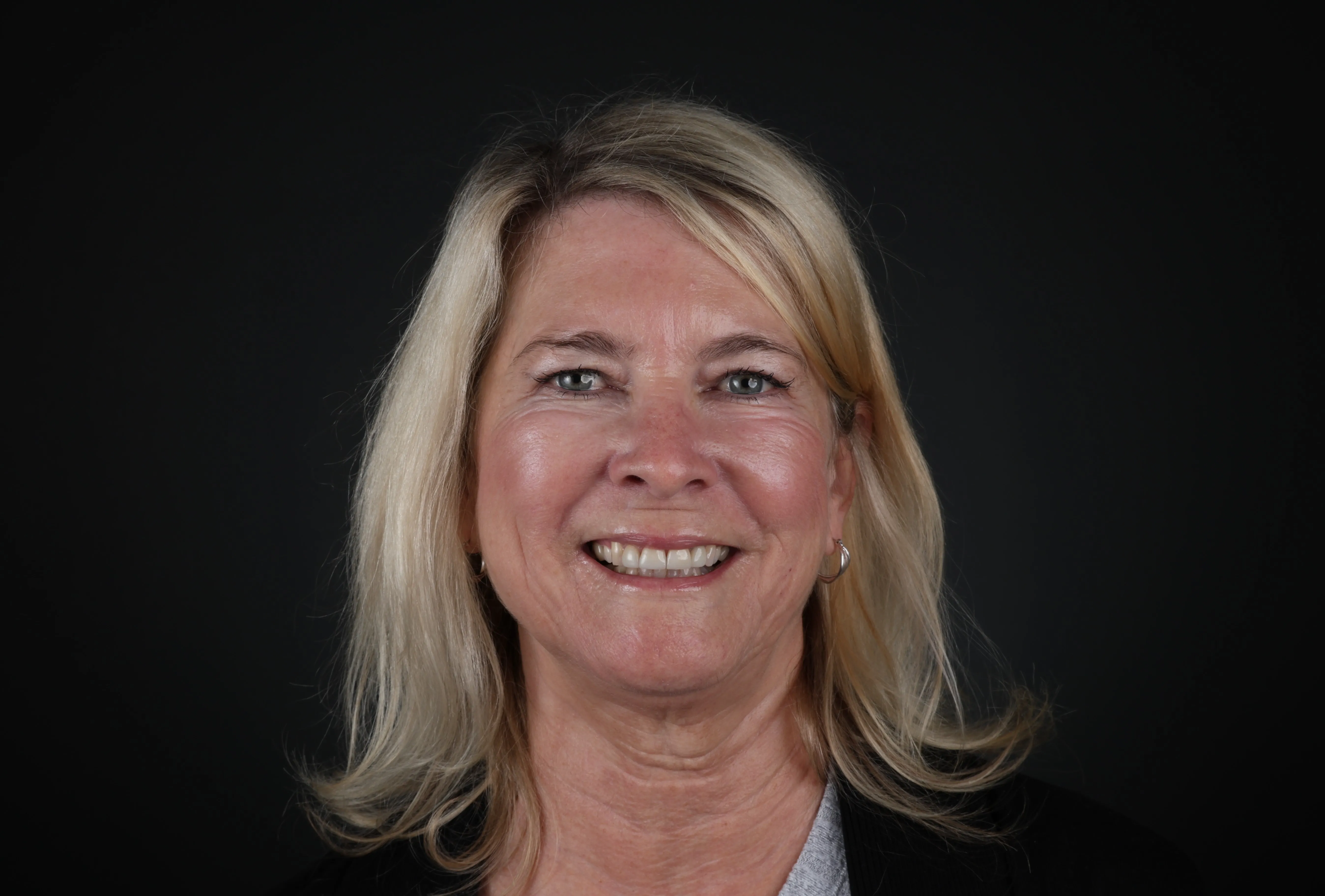 Dental crown smile result at Livewell Dental in Fairfax Station, VA
