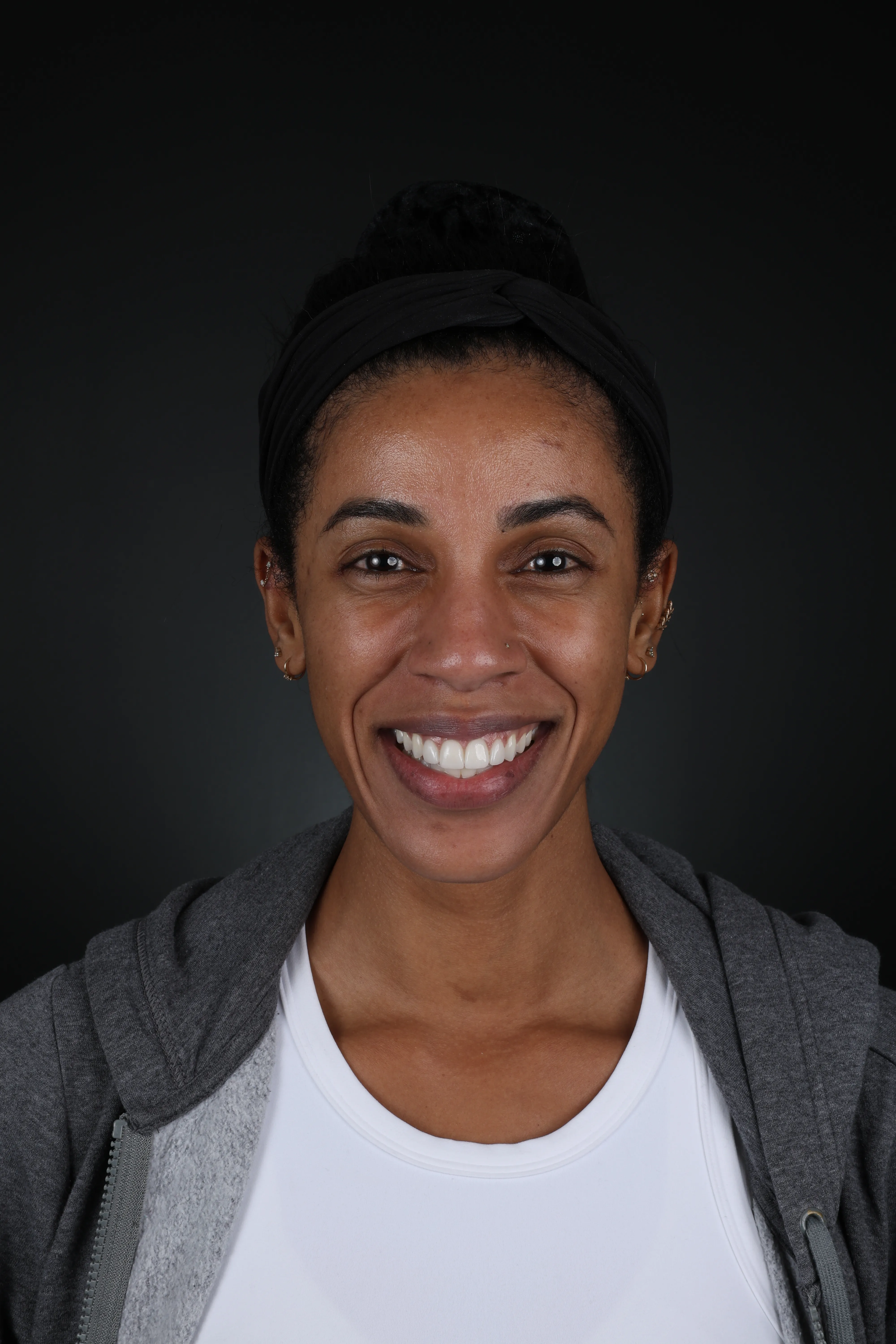 An Image for a patient who had an oral Surgery at Livewell Dental in Fairfax Station, VA