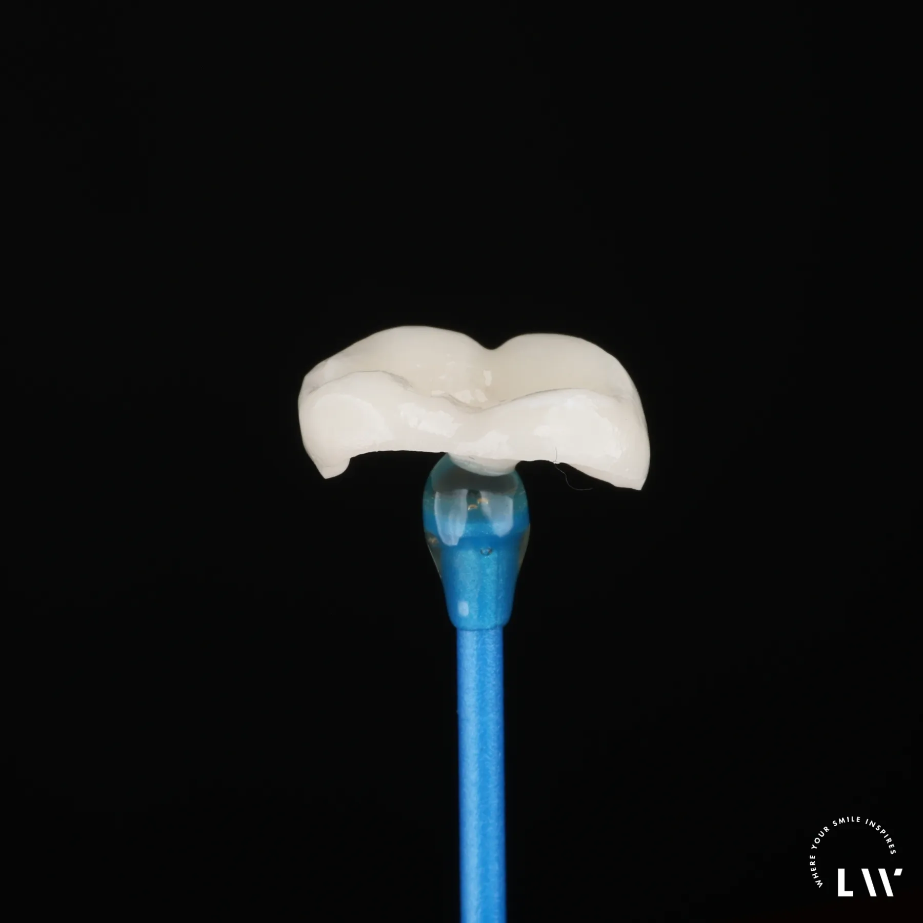 Dental crown, crownlay, and onlay examples