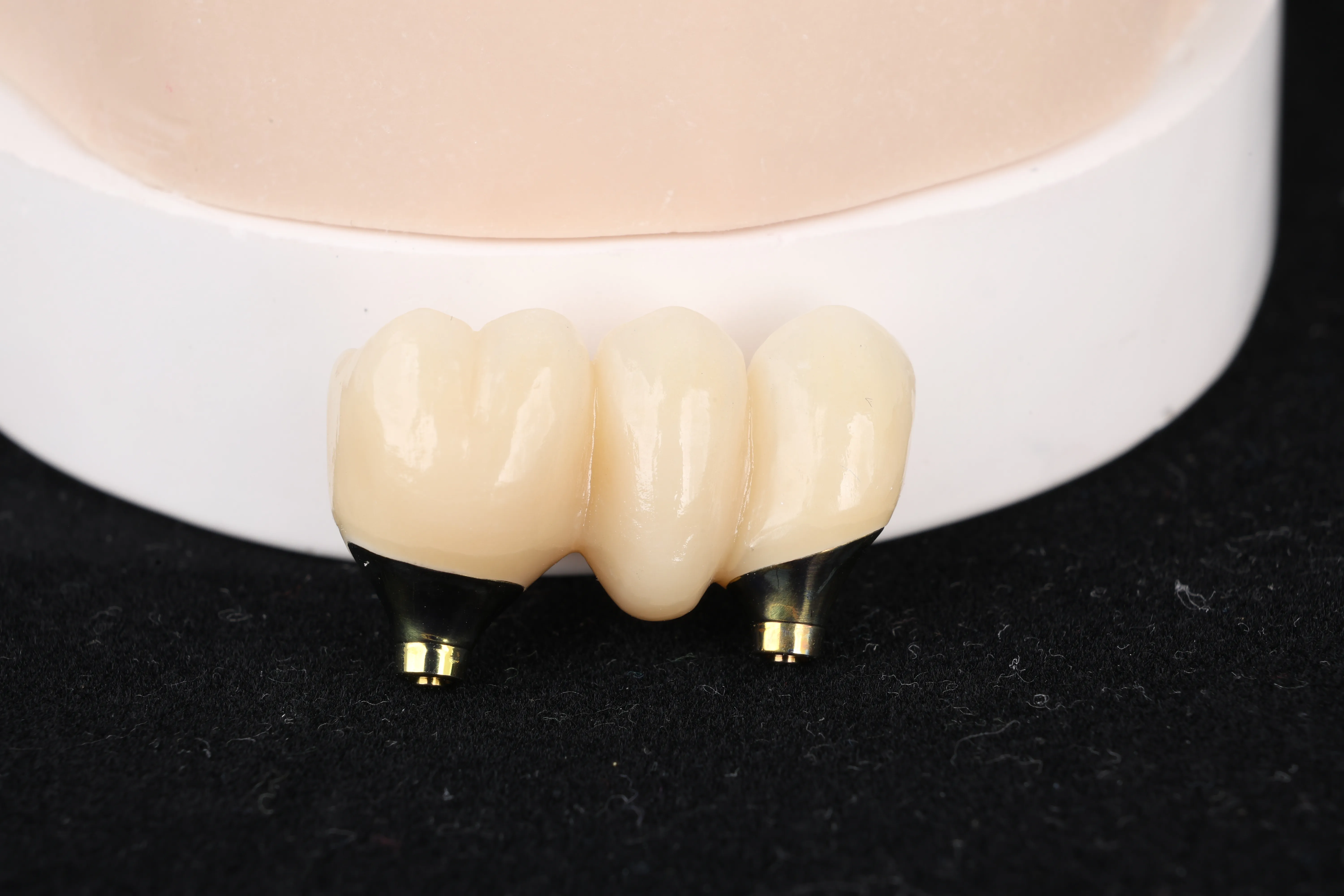 Implant bridge smile result at Livewell Dental in Fairfax Station, VA