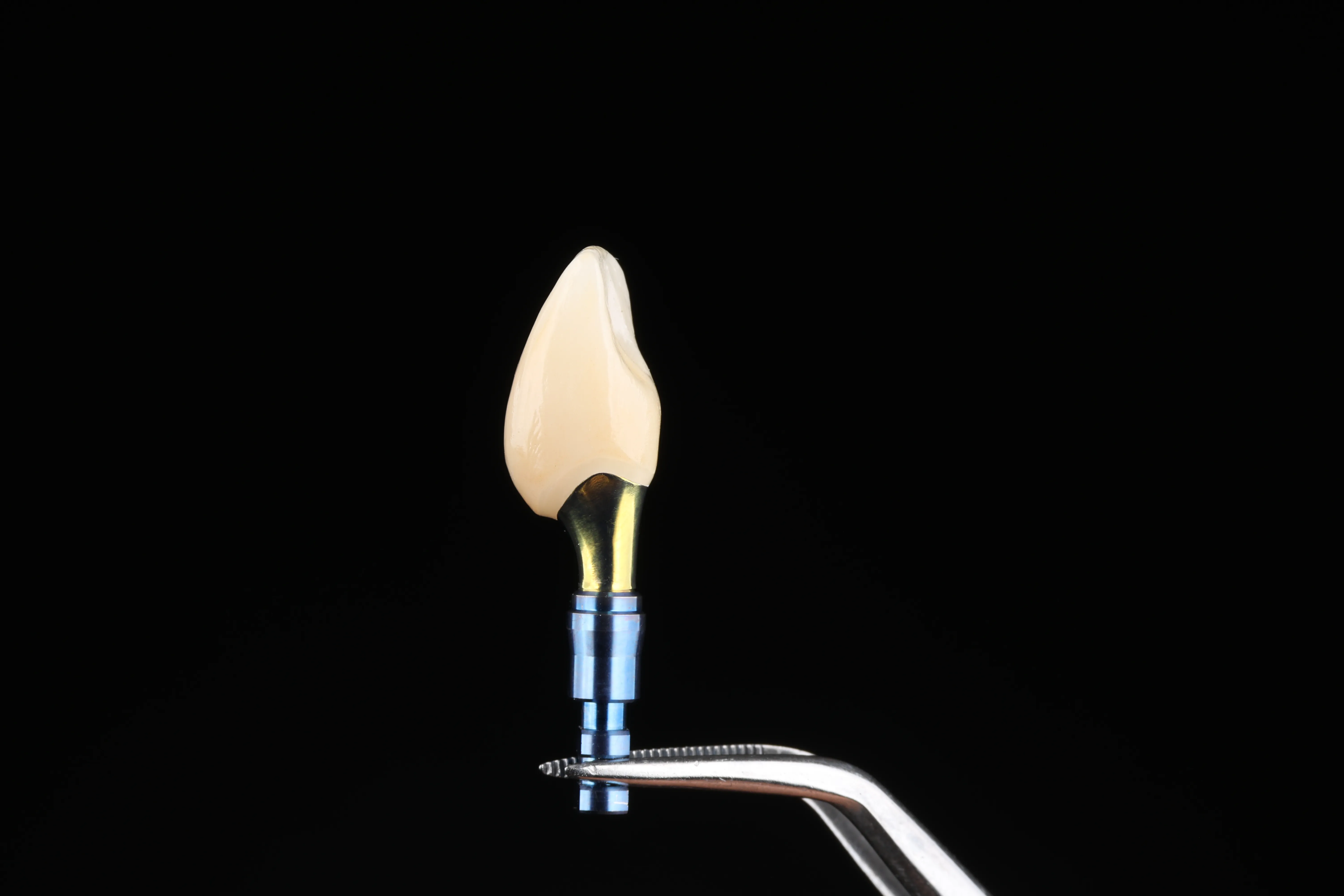 Dental implant diagram showing crown, abutment, and implant post